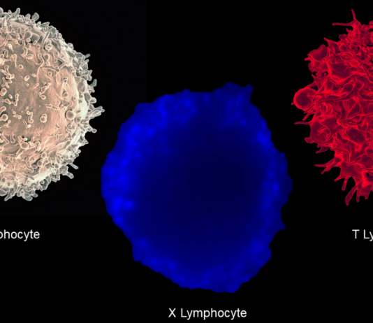 Новый тип иммунных клеток обнаружен у пациентов с диабетом 1-го типа